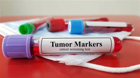 tumor marker test dropped 100 points since first chemo|tumor markers going up.